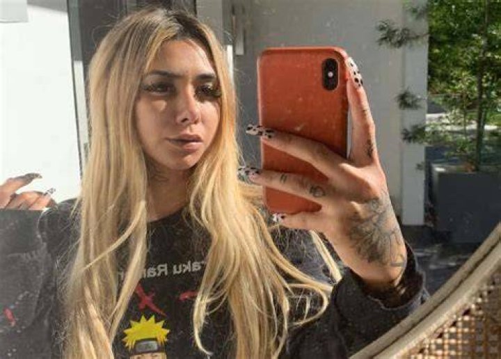 Ally Lotti wiki