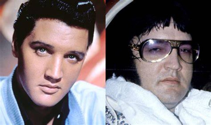 Cause Of Elvis' Death
