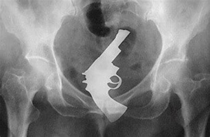 Crazy X-Ray Images