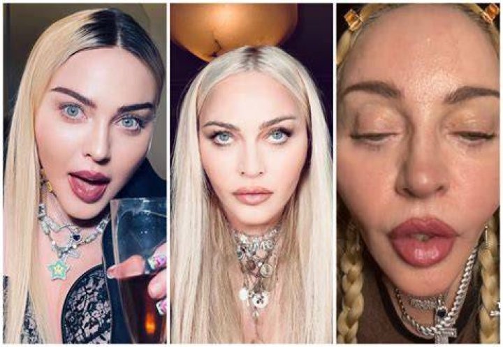 Filter or Filler? Madonna Looks Unrecognizable in a Recent TikTok: 'This is Completely Unsettling'