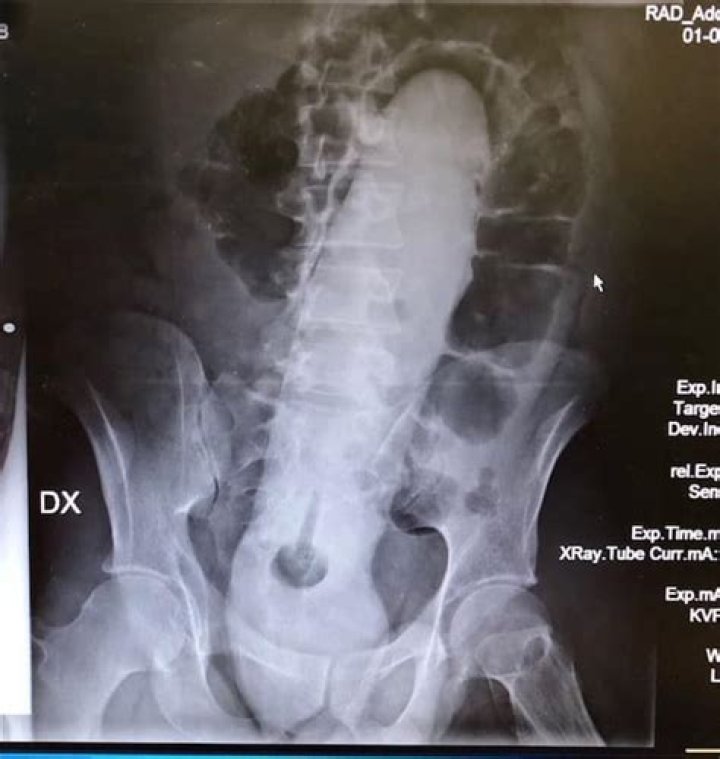Funny X Rays Live Round