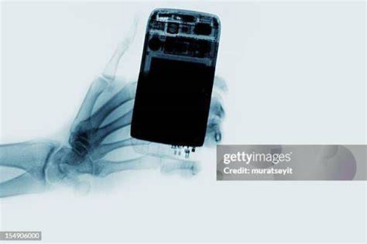 Funny X-Ray Images Cell Phone