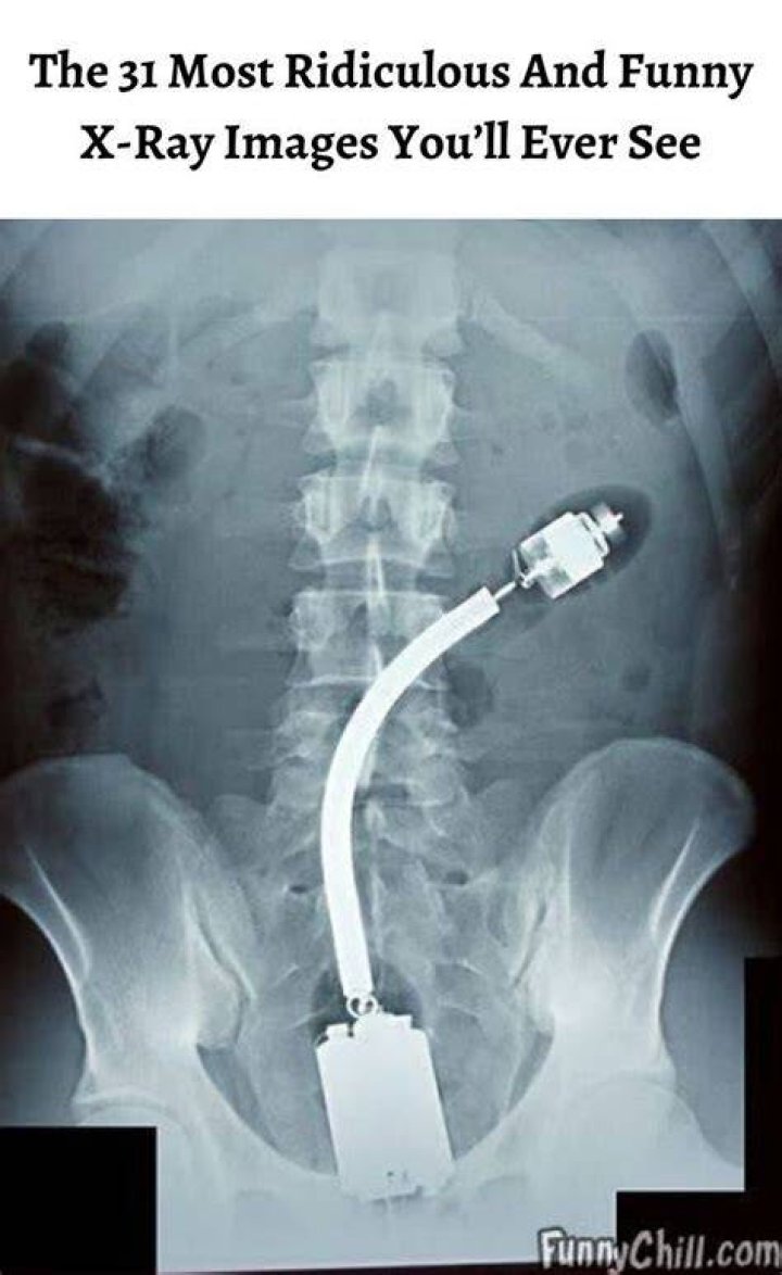 Funny Xray Toothbrush