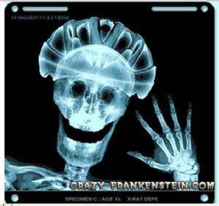 Funny Xrays