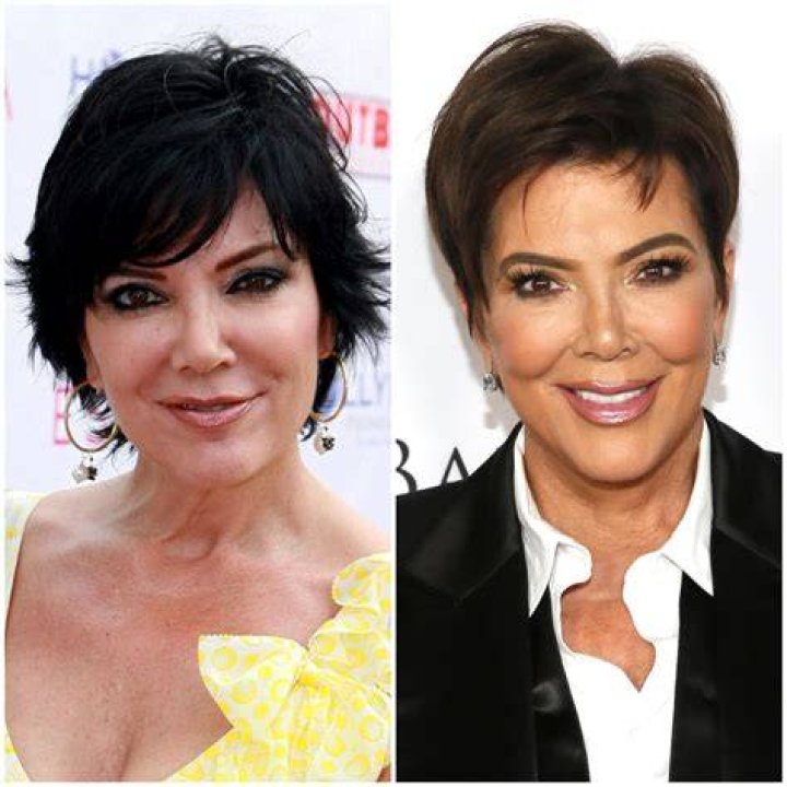 Kris Jenner Transformation Then vs. Now Photos