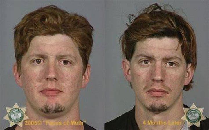 Meth Epidemic Mugshot