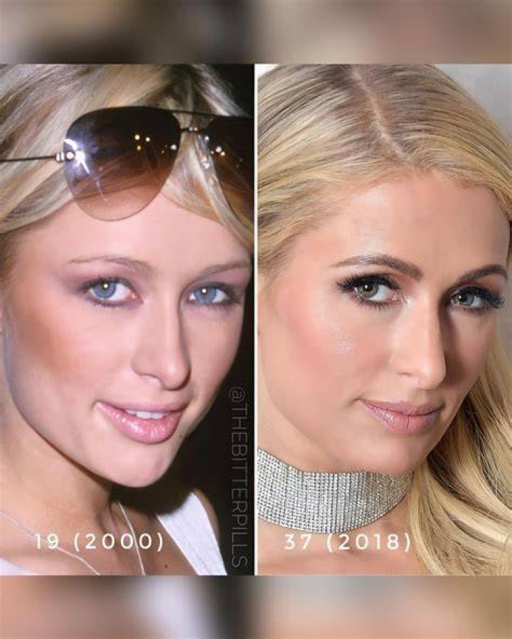 Paris Hilton Transformation 2003