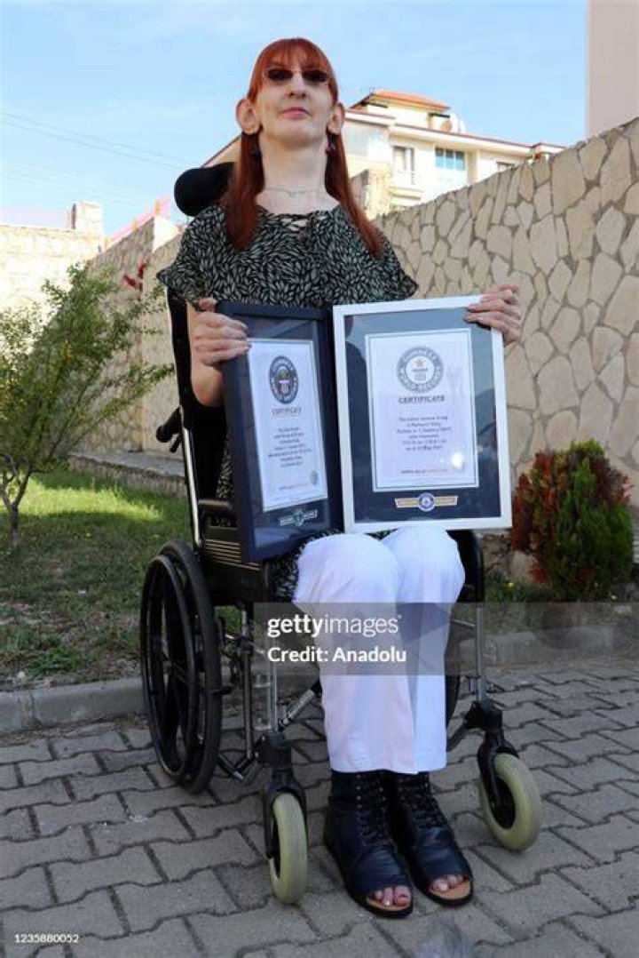 Rumeysa Gelgi is confirmed as the world's tallest living woman by Guinness World Records