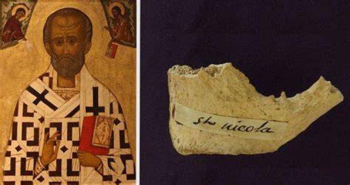 St Nick Pelvis