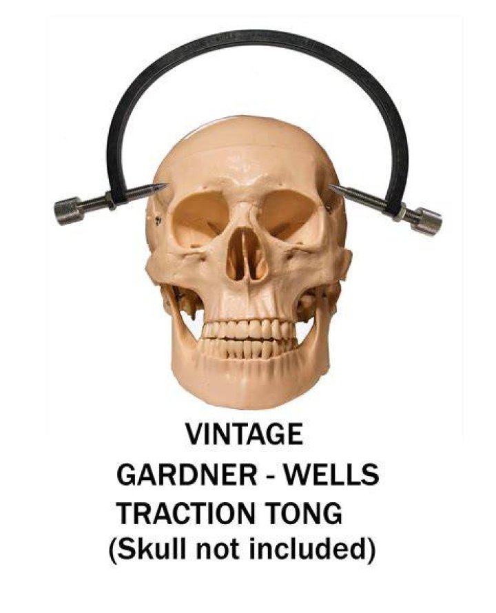 Tongs In Head Photo