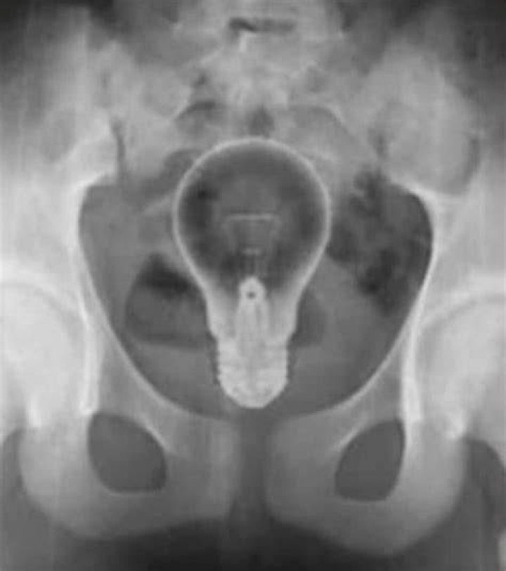 Weird X Rays Lightbulb
