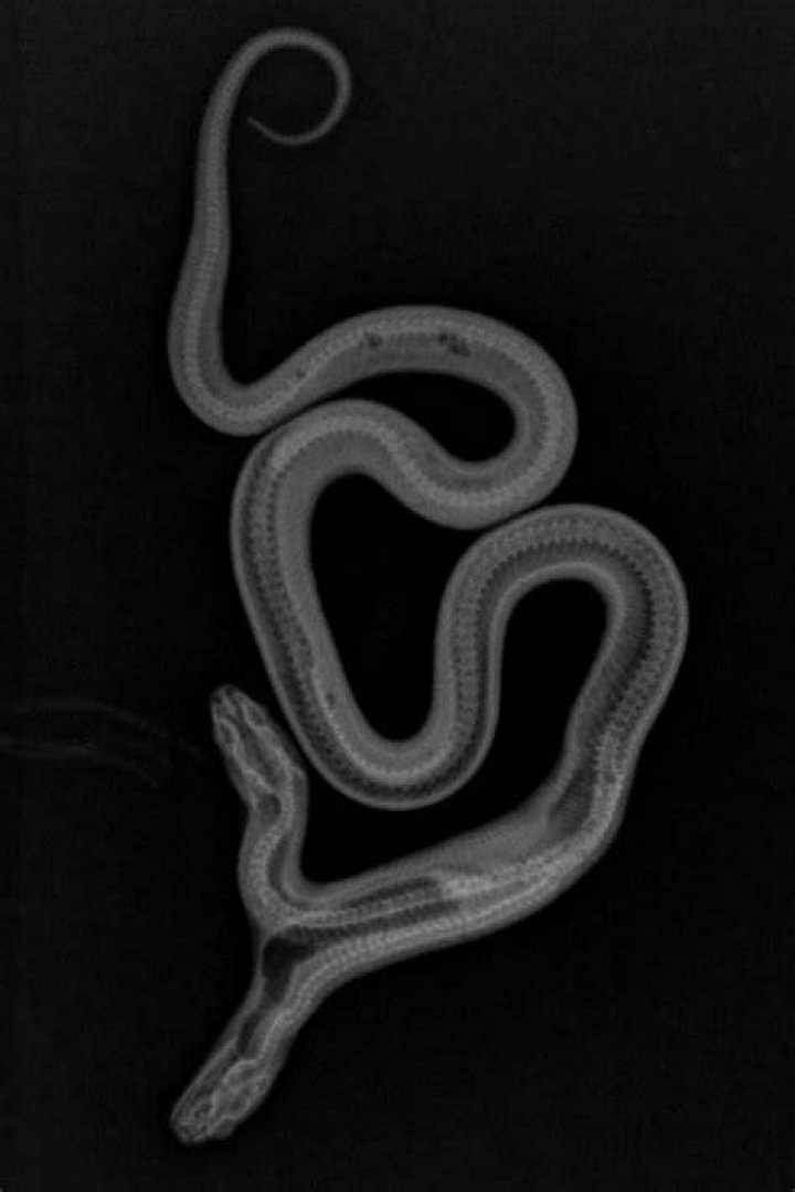 Xray Two Headed Snake